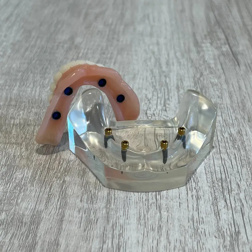 snap-in implant dentures Lenexa, KS