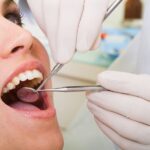 oral cancer screening